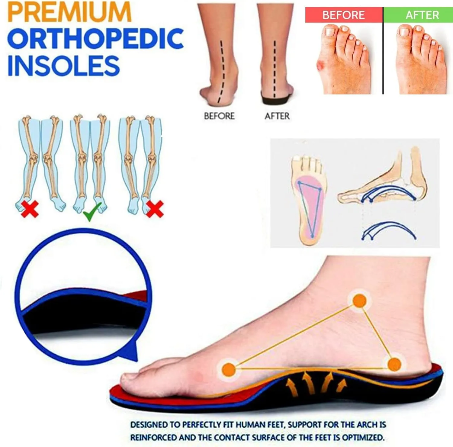 Orthotic Sandals for Women Summer Breathable Open Toe Non-Slip Casual Wedge Sandal Vintage Roman Shoes